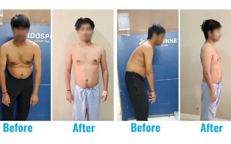 A 31-year-old who lived on a chair… until his spine finally said, ‘Enough’