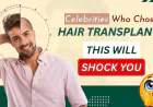 Celebrity Hair Transplant: You’d Never Guess They Had a Hair Transplant- But They Did